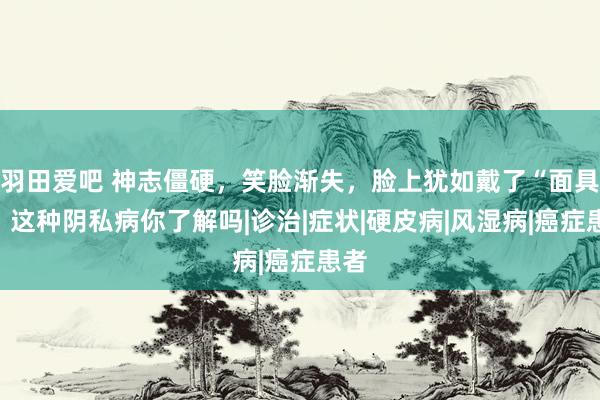 羽田爱吧 神志僵硬，笑脸渐失，脸上犹如戴了“面具”，这种阴私病你了解吗|诊治|症状|硬皮病|风湿病|癌症患者